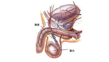 睾丸畸形