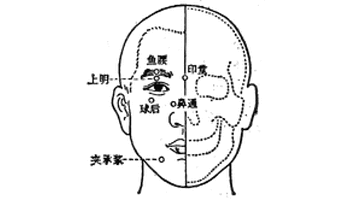 基本资料 简介 经外奇穴之一,本穴位置在眼球的后方,故名球后.