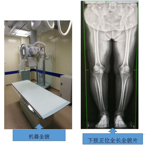 省内首台\＂长骨拼接功能DR照相机\＂在哈市一院投入使用