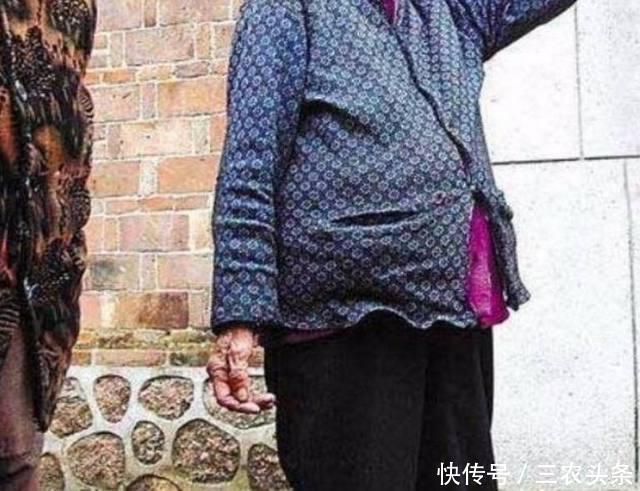 70多岁农村老人挺着大肚子,医生说她怀孕了
