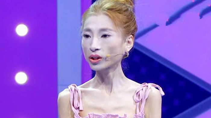 女子为减肥曾绝食,体重只有56斤,网友:无人敢要