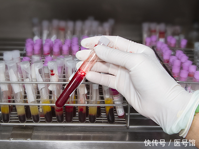 血常规检查哪些可以排除白血病