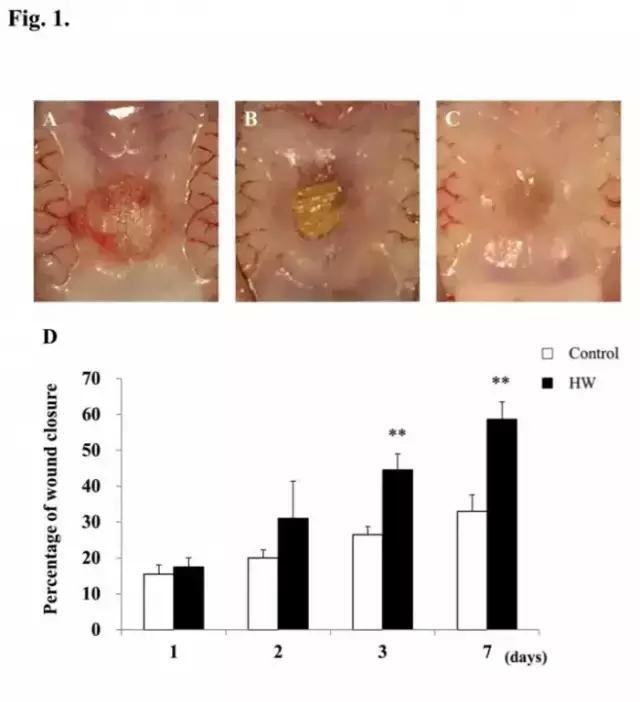 口腔溃疡要分型治疗