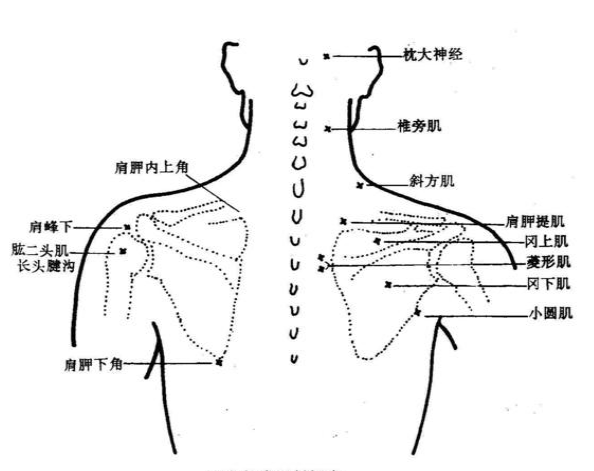 颈肩部常用封闭点