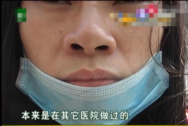 花了两万八还是蒜头鼻要退款? 绝对退不了!
