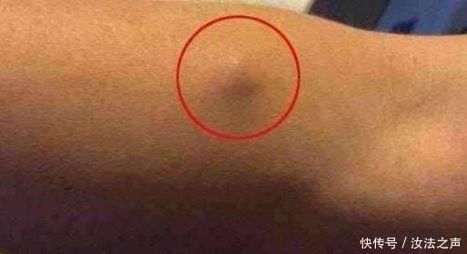 警惕!身体出现这几种情况,暗示或有大病发生,癌症离你不远了