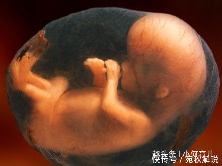 胎儿缺氧时,孕妇会有2个危险症状,别不以为然