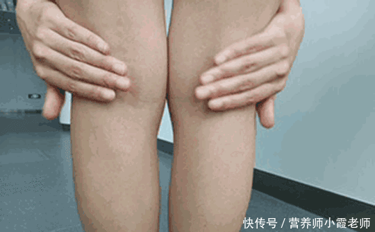 怎么晒背可以祛湿气 t01599d85a9fed5100f.gif