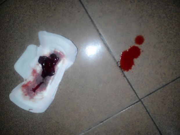 请问:怀孕有2个月了做人流有危险吗?在上海当天做当天可以走吗?