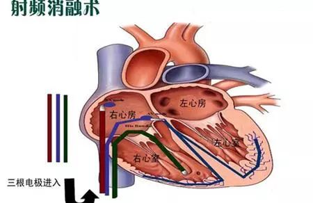 情人节,你\"怦然心动\"了吗?严肃点,这是一篇正经科普