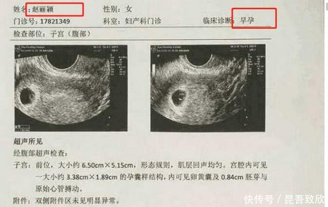 冯绍峰宣布赵丽颖怀孕,唐嫣却不幸躺枪,只因为