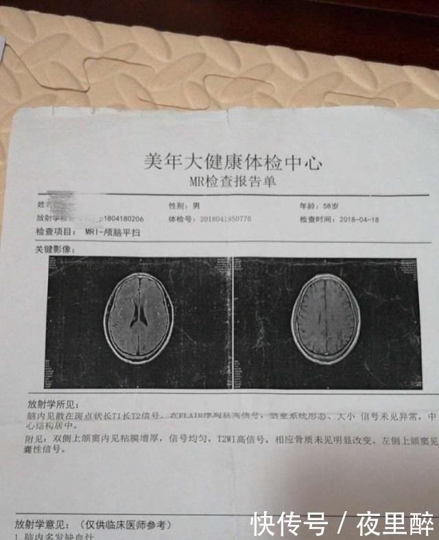 体检报告称鼻窦炎,半年后确诊鼻咽癌中晚期患