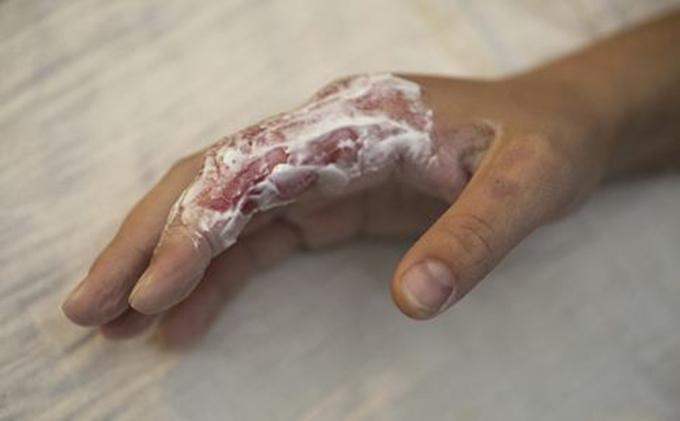 老婆快生了, 腹痛难忍咬破了俺手, 她进产房后我