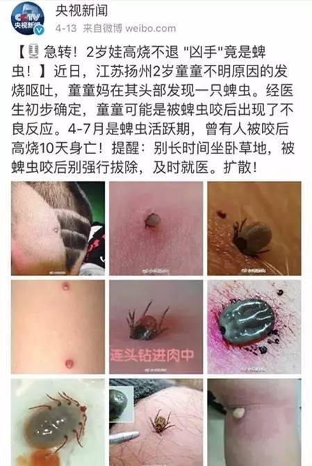 比蚊子可怕多了的这种小虫,孩子无故发烧可能是因为它