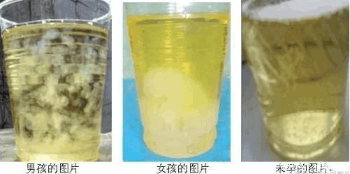 男宝女宝早知道: 9种方法教你判断胎儿性别, 接