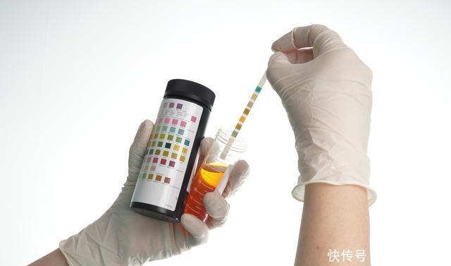 尿蛋白是什么原因引起的老实说,多是早期肾脏