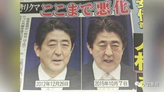 日记者称安倍患肺癌只剩3个月 此前被疑患大肠癌 - shxhxthq - 王的盛宴博客 日记者称安倍患肺癌只剩3个月 此前被疑患大肠癌 - shxhxthq - 王的盛宴博客