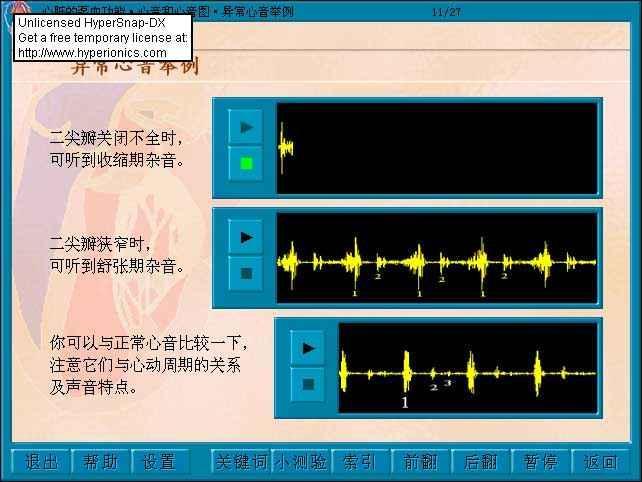 概述 null 心音异常 通过心音图检查证实正常心音有四个按其出现的