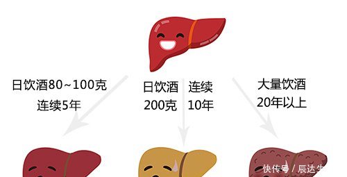 脂肪肝中度严重吗能自愈吗 六大症状显示非常