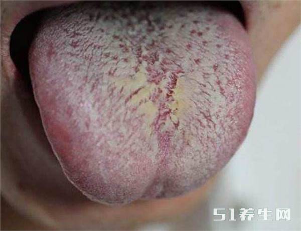 这些水果吃越多湿气越重,很多人却爱不释手