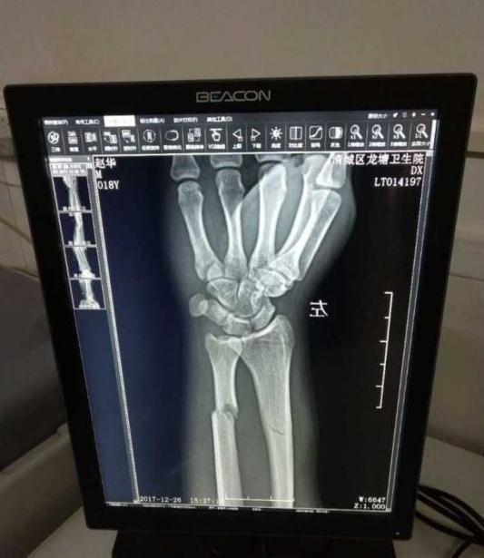 中国最大碰瓷'天团'! 6个团伙瓜分全国市场 为逼