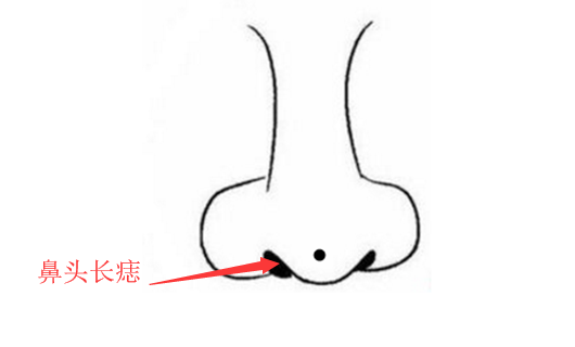 旺财痣，身上此处长善痣，发横财，进偏财，看你脸上得是不是？