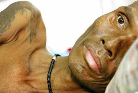 得了艾滋病,最多能活几年?