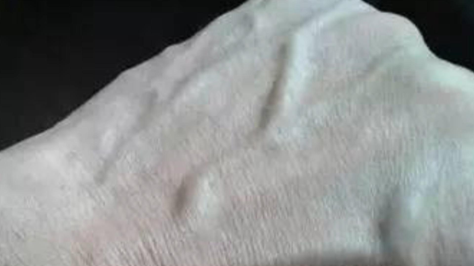 "青筋" 凸起 意味着什么 99%的人都不知道