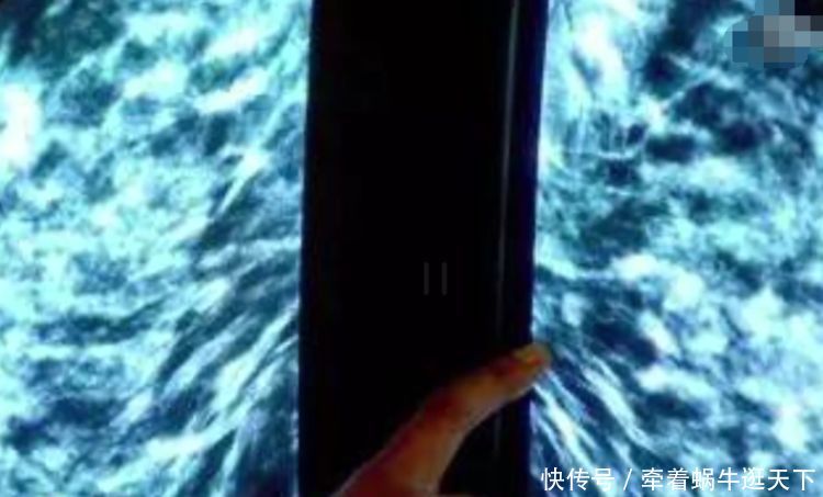 女子喝豆浆3年,突然胸口疼,到医院检查的结果