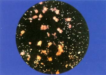 沙眼衣原体阳性 | 知客分享