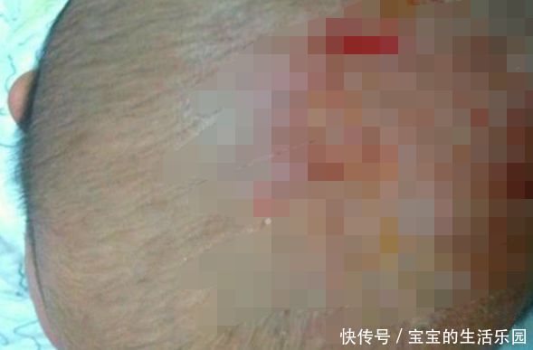2个月宝宝头上有脏东西,妈妈抠掉后,宝宝却进
