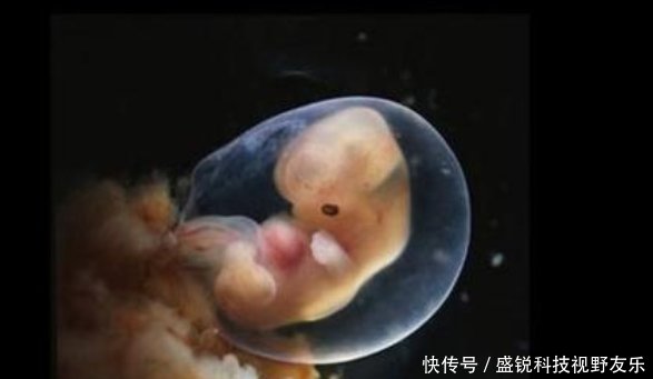 怀孕后,胎动总在右侧和胎儿性别有关吗或许和
