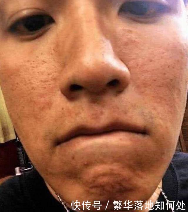 男星素颜也吓人:王俊凯满脸痘,黄子韬土气,最后