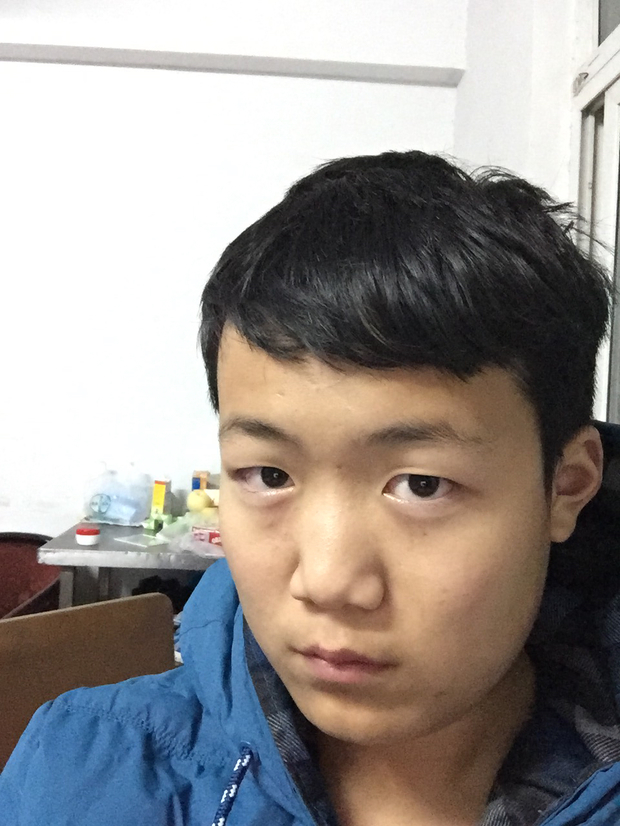 我是个男生小时候长的很帅,现在13岁变丑了怎么办 男生