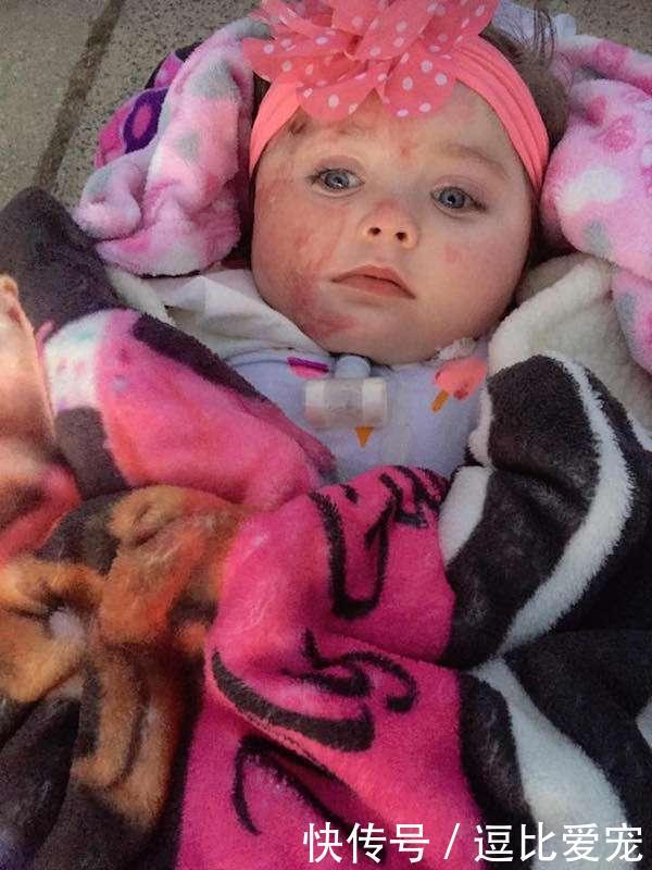 家中大火妈妈以为女儿已经死了,扑灭火后才知