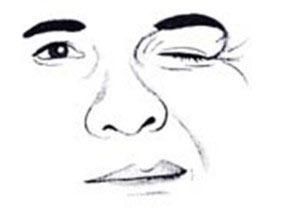 五大习惯助你远离面肌痉挛