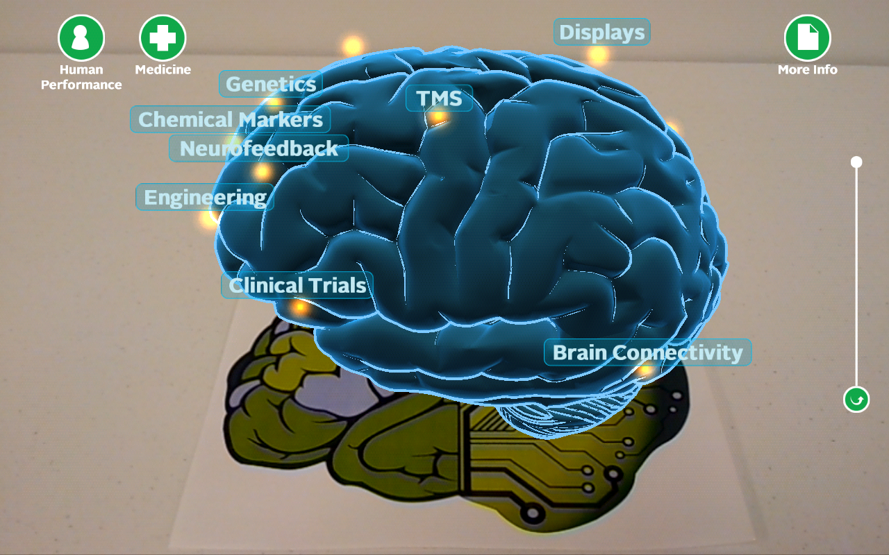 What is PET Scan for Brain: Unveiling the Secrets of Brain Imaging