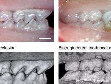 盘点7个未解之谜，小鼠干细胞能培育出牙齿吗？