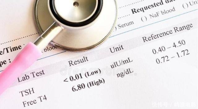 为什么怀孕要做甲功检查?很多准妈妈不知道,记