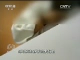 焦点访谈 《焦点访谈》 20170331 如此“整形师”