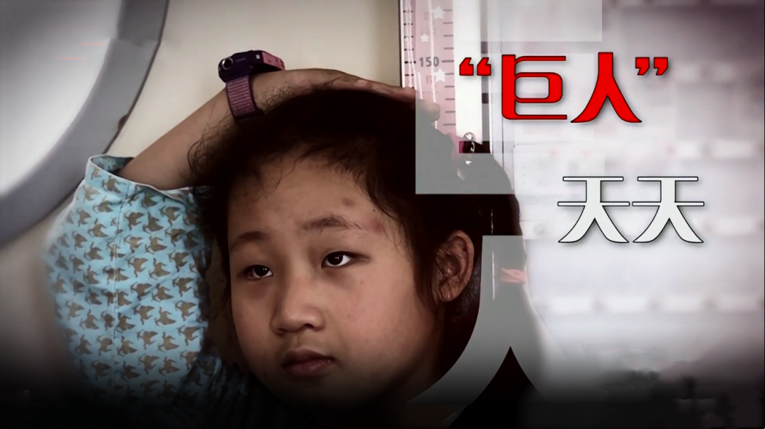 生命缘 第13季 女童4个月长高15厘米竟是患上“巨人症”