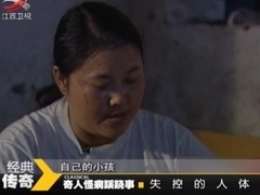 经典传奇 奇人怪病蹊跷事之失控的人体