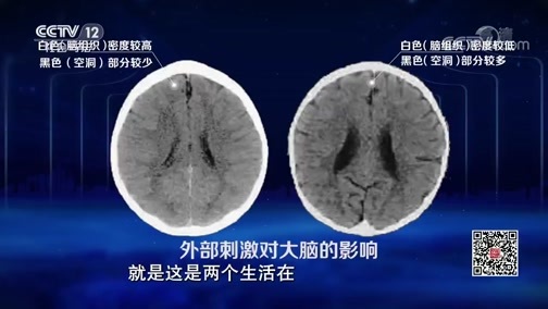 《法治中国说》第二季·大检察官说 20190109 守护成长