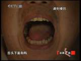 健康之路 异食怪人
