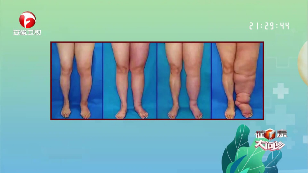 疏通淤堵的“四肢水管”