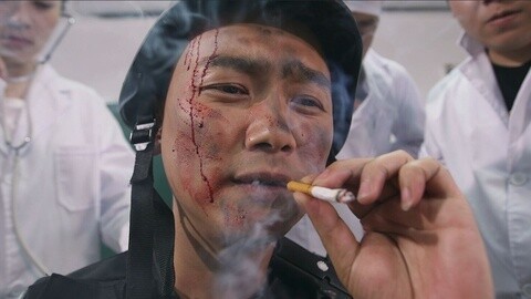 陈翔六点半 天生骄傲！就是不用麻药