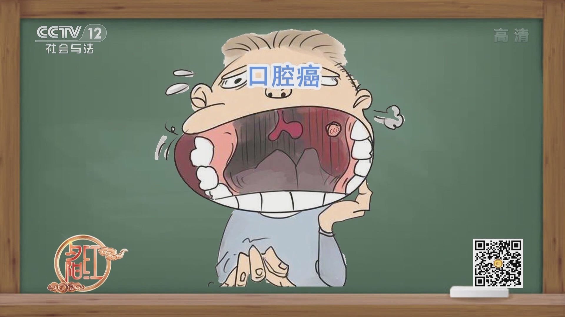 《夕阳红》 20211128 吃出来的癌症——小小槟榔竟能引发口腔癌？