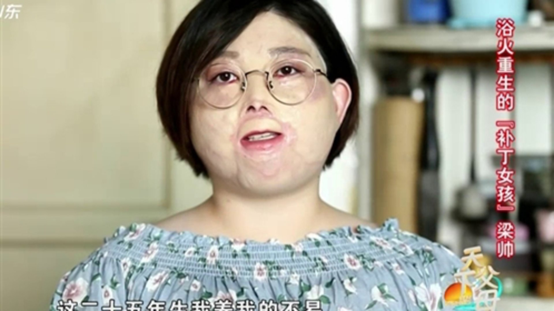 天下父母 浴火重生的“补丁女孩”梁帅
