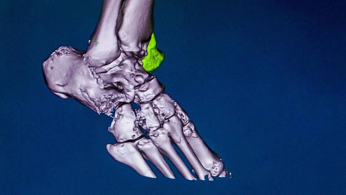 创新中国 第3集