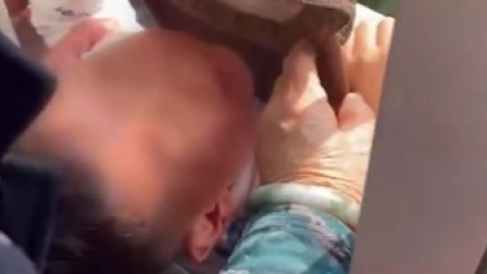 @所有人 奶娃趴窗看景滑倒，头卡8楼防盗窗